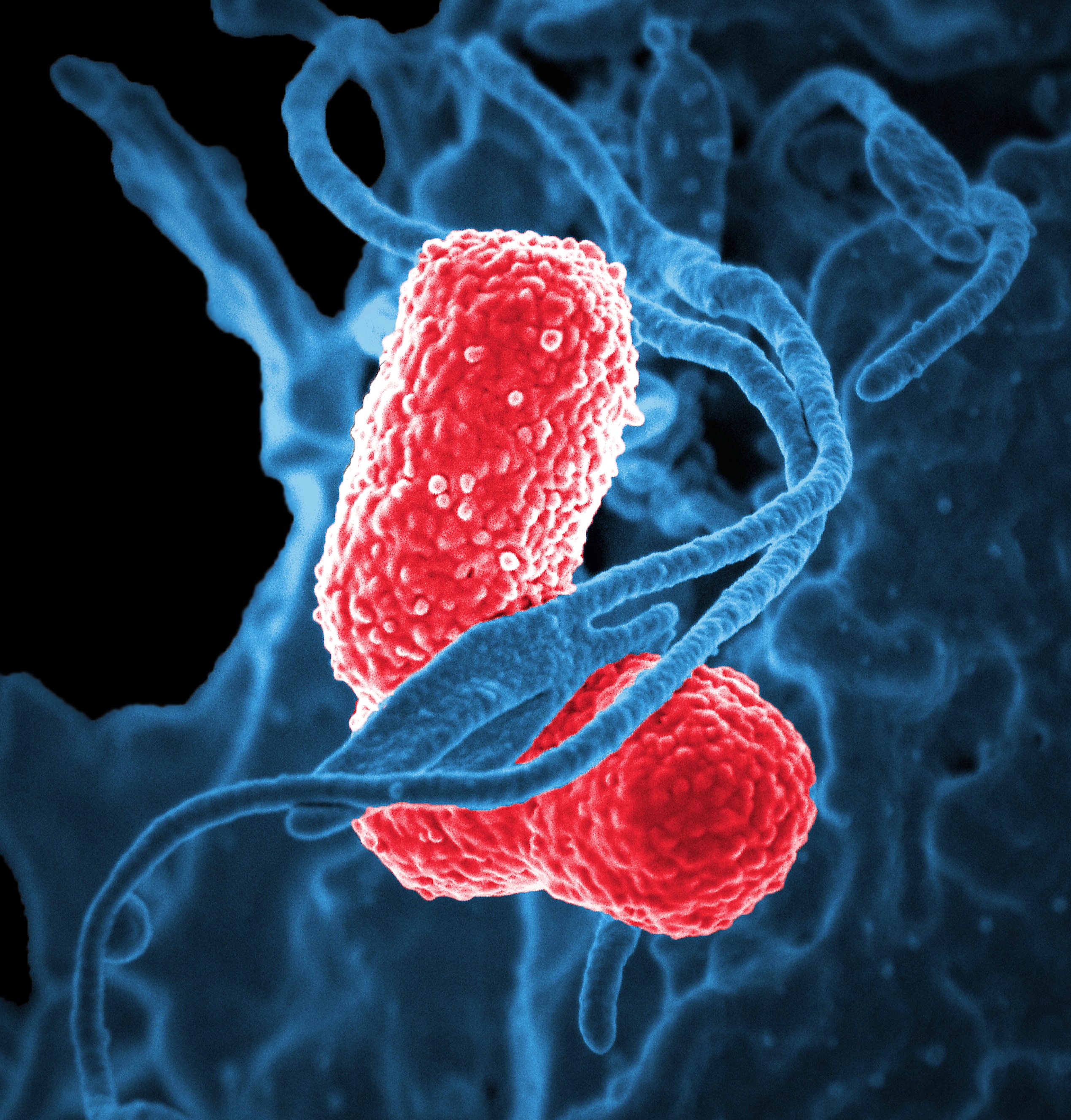 Vitamin E may prevent pneumonia in non-smoking elderly men