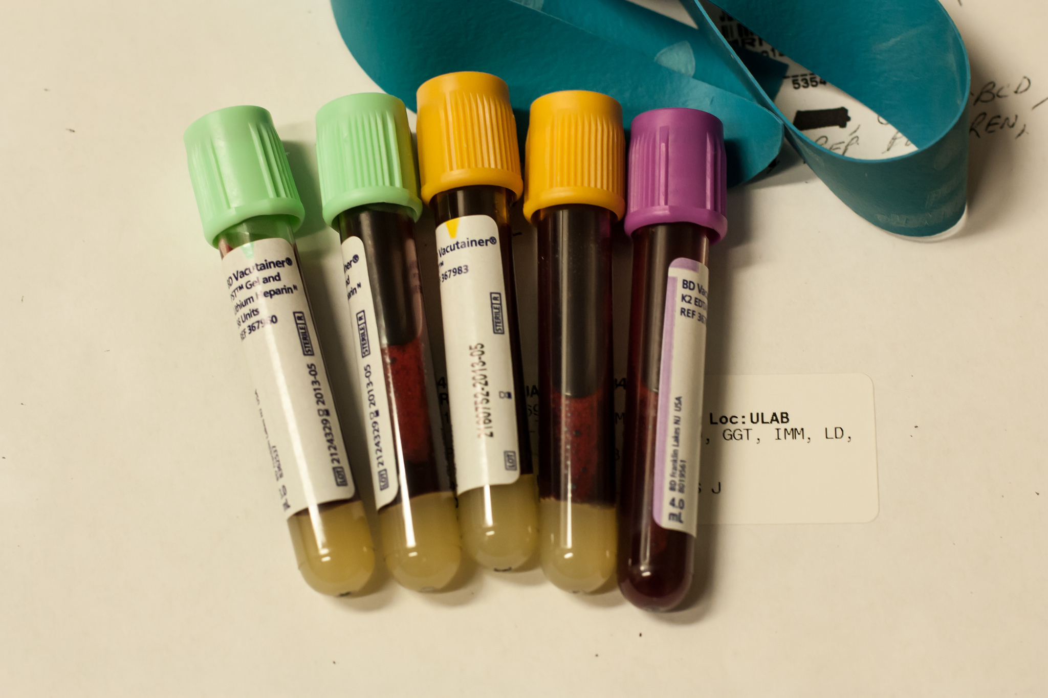 blood test