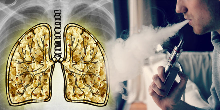 Popcorn Lung: The Disease that Affects Vapers, Smokers, and Popcorn Fans